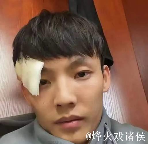 徐杰遭邬挺嘉重伤后首次发声,展现大格局,同曦队高层设宴致歉 徐杰遭邬挺嘉重伤后首次发声,展现大格局,同曦队高层设宴致歉